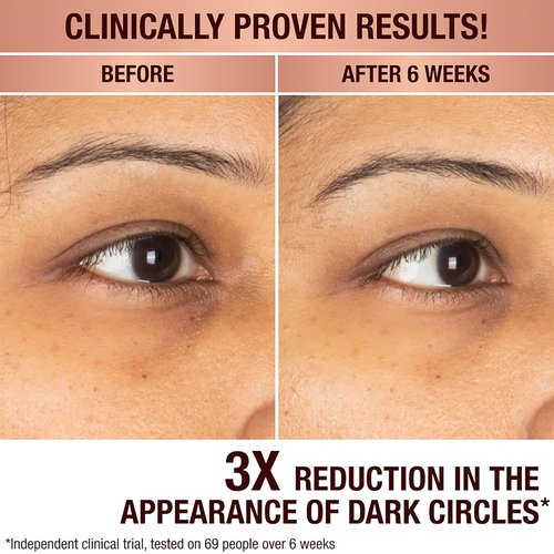 Charlotte Tilbury Radiance Recovery Serum - Tranexamic Acid & Vitamin C for Brighter Under Eyes | Reduces Dark Spots & Redness