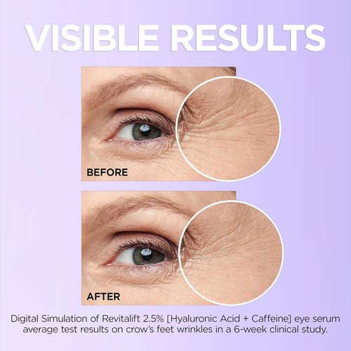 L'Oreal Paris Revitalift Eye Serum - Hydrating Formula with Hyaluronic Acid & Caffeine | .67 fl. oz.