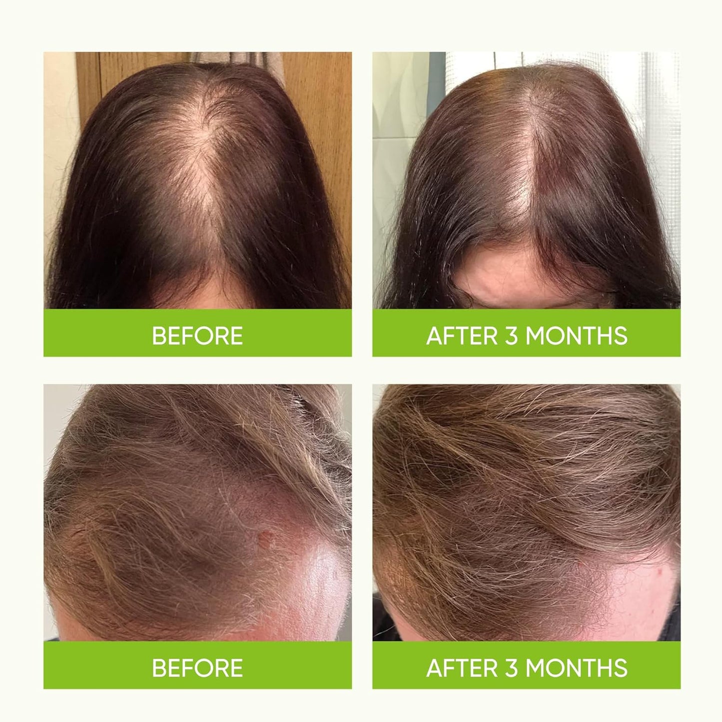Svvimer Hair Growth Serum Spray - Rosemary & Batana Oil with Biotin for Thicker Hair - 2 Fl Oz