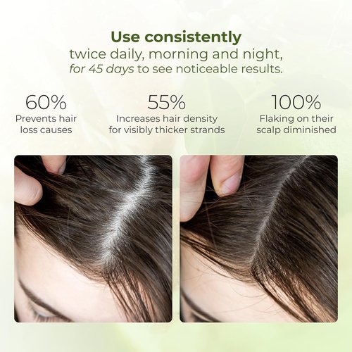 Cocoon Pomelo Grapefruit Oil Hair Tonic - Vegan Scalp Serum for Thinning & Damaged Hair | 4.73 fl oz