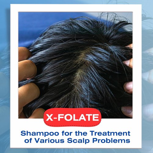 Mediceuticals X-Folate Shampoo - Anti-Dandruff Formula for Flaky Scalp Relief - 8.45 oz/250ml