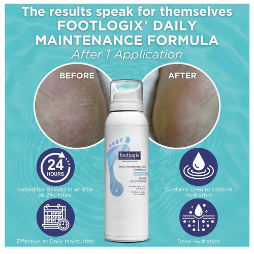 Footlogix Daily Maintenance Formula - Nourishing Foot Moisturizer Mousse for Dry Skin | 4.23oz