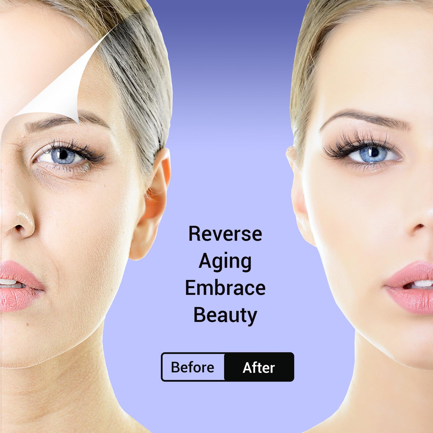 SOZOOM PDO Screw Threads, PDO Thread Lift Korea Whole Body Lifting (100PCS-27G-60mm)