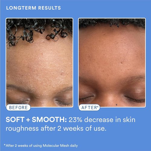 Experiment Molecular Mesh Barrier Repair Face Moisturizer - Soothing Lightweight Cream for Strength & Redness Relief - 2 FL OZ Vegan Formula for Sensitive Skin