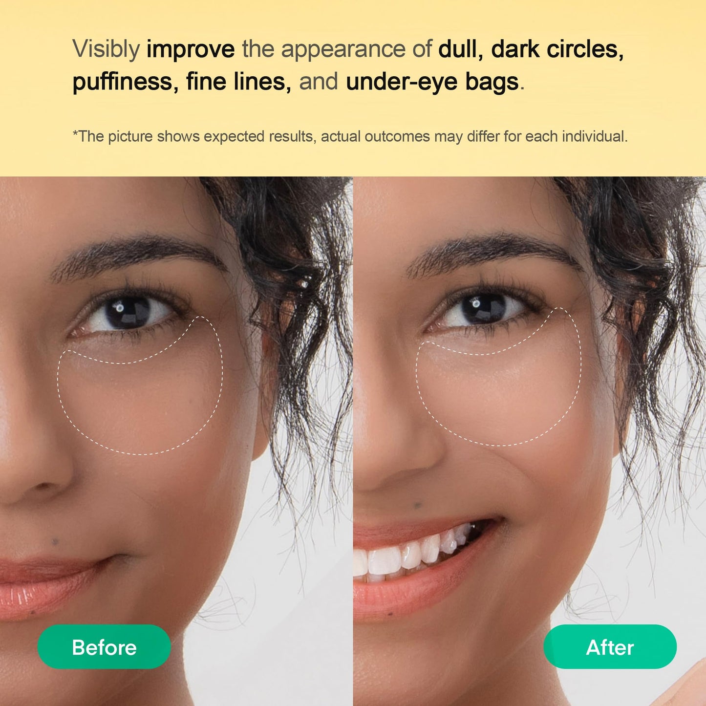 Terez & Honor Under Eye Patches for Dark Circles - 60 Korean Hydrogel Masks for Puffiness, Bags, Wrinkle with Caffeine, Hyaluronic Acid, Niacinamide - Undereye Hydrating & Cooling, Vegan, No Fragrance