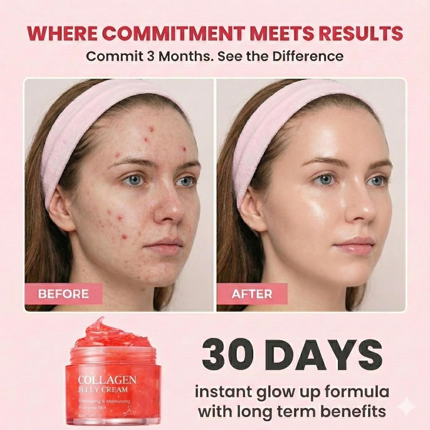 Skiennix Korean Collagen Jelly Cream - 24H Hydration & Glow, Boosts Elasticity & Smoothness | 1.76 fl oz