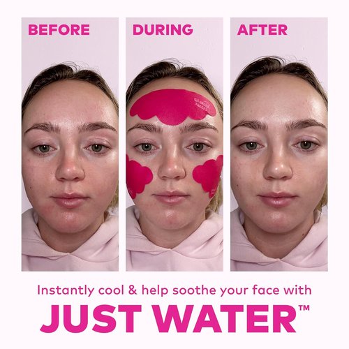 MakeUp Eraser Face Cooling Clouds - Reusable Facial Patches for Reducing Redness & Irritation | Instant Cooling