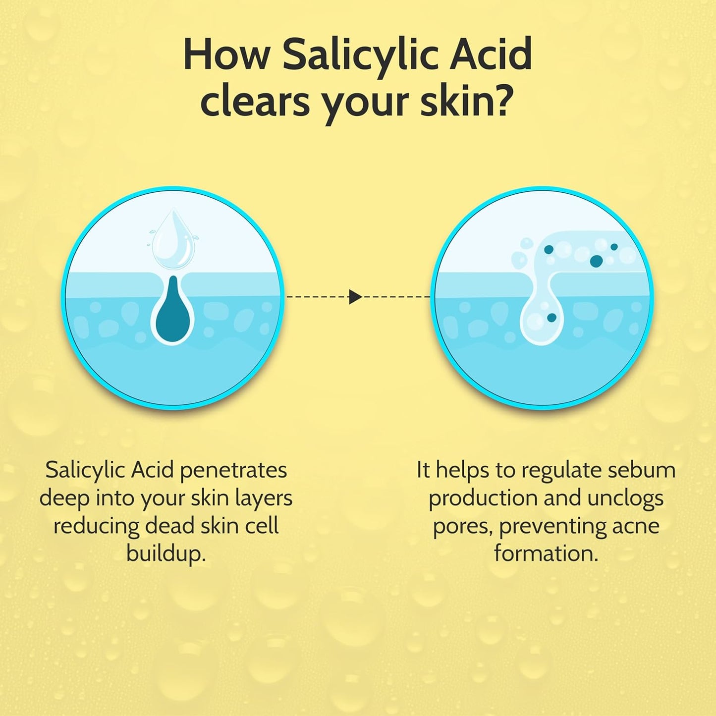 Chemist At Play 2% Salicylic Acid Face Serum - Treats Acne & Controls Oil | Fades Marks | 30ml