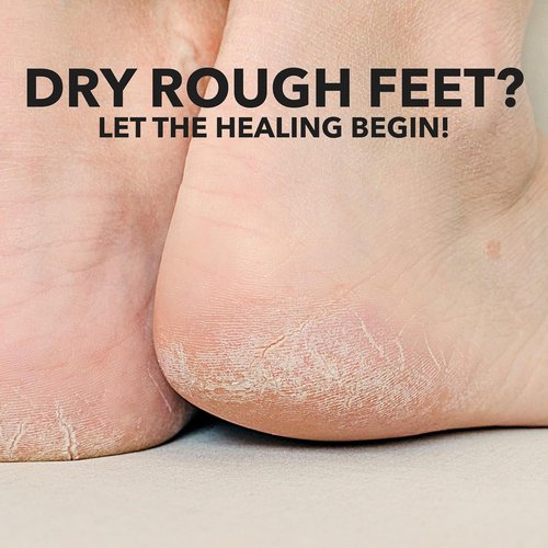 Adamia Therapeutic Foot Cream - Pure Macadamia Oil, Fragrance-Free & Paraben-Free, 4 Oz Tube