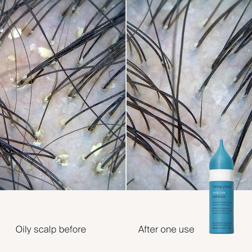 Living Proof Scalp Care Exfoliator - Deep Cleanse & Revitalize Scalp Health | 8 oz