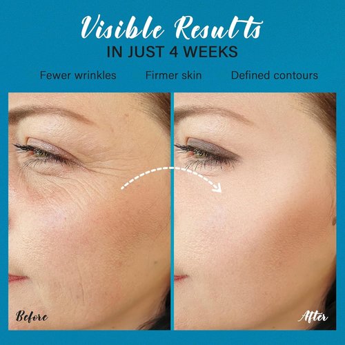 Regine Switzerland Neck Cream - Instant Face Lift & Anti-Aging Moisturizer | 6-in-1 Collagen, Retinol & Hyaluronic Acid Formula
