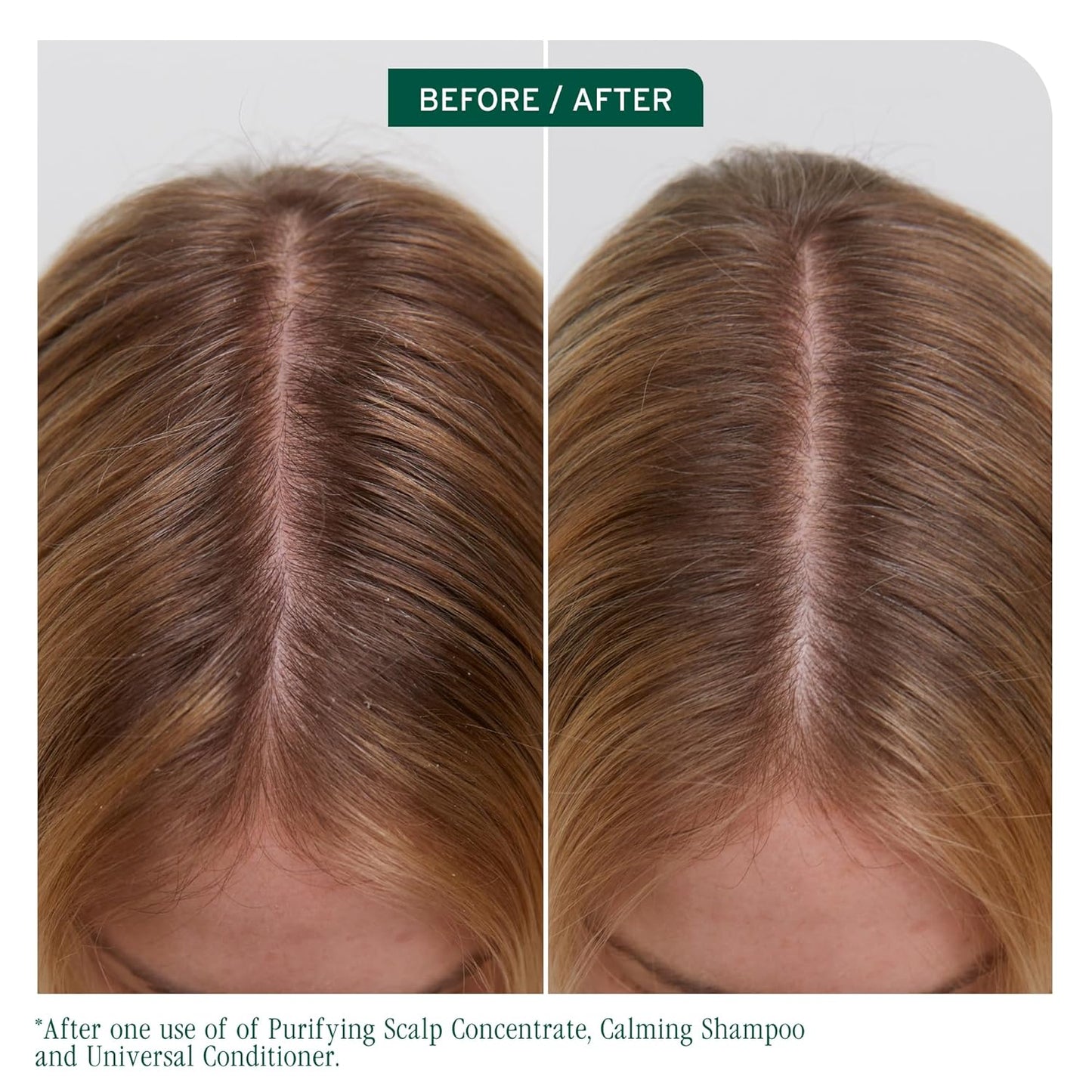 Biolage Scalp Sync Calming Shampoo & Conditioner Set - Hydrating Formula for Dry, Sensitive Scalps | Vegan & Paraben-Free