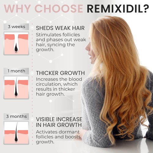 Minoxidil 2% Hair Regrowth Spray for Women | Thicker, Fuller Hair - Clinically Proven Formula - 60 ml