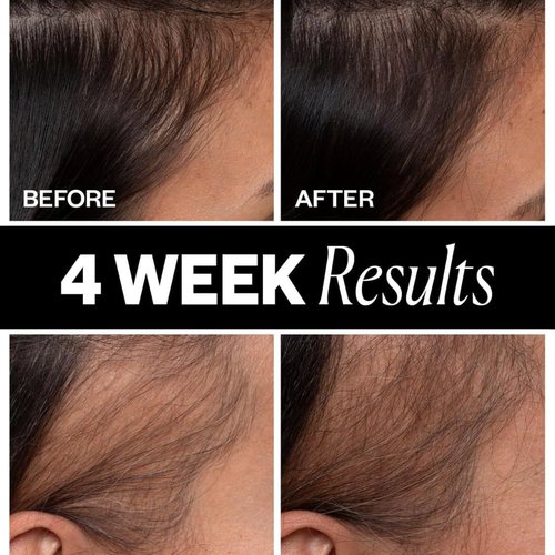 IGK Scalp Treatment for Hair Growth - Thickening Serum for Thinning Hair | Clinically Tested Mist | 2.1 Oz