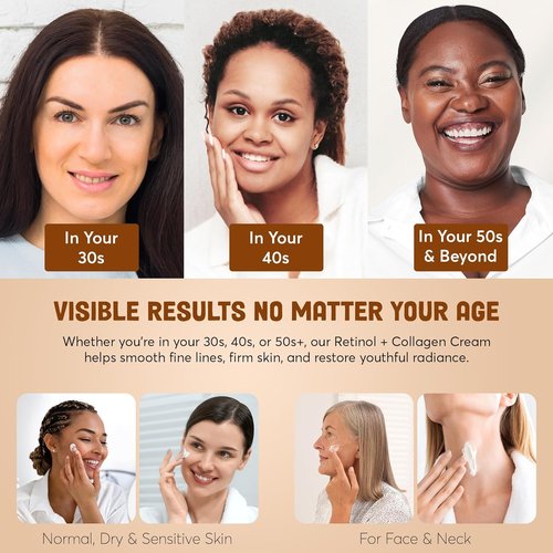 Live Healthy Retinol Cream - Anti-Aging Face Moisturizer with Collagen & Hyaluronic Acid | 1.05 fl oz
