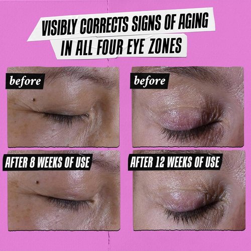 Kiehl's Super Multi-Corrective Eye Cream - Anti-Aging Formula with Bilberry Seed Extract & Collagen Peptide for Firm, Smooth Skin