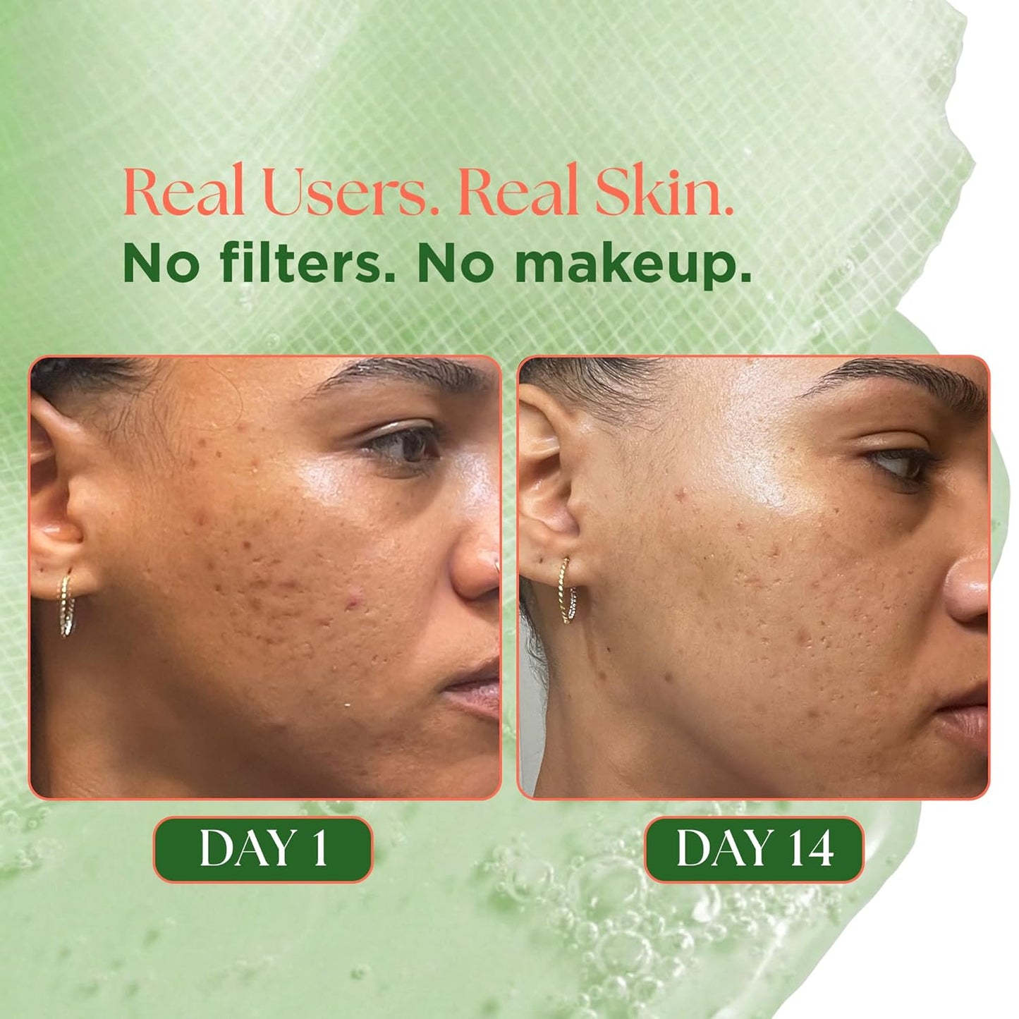 Skiennix Matcha Facial Moisturizer - Hydrating & Firming Cream with Rose PDRN for All Skin Types | 3.53 oz