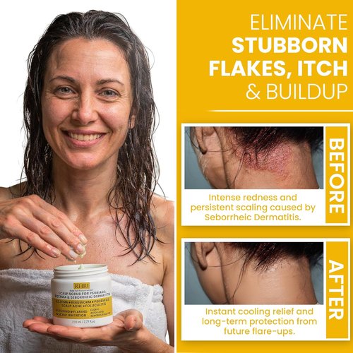 Regine Switzerland Anti-Fungal Pre-Shampoo Scalp Scrub - Soothes Psoriasis & Eczema | DHT Blockers & Tea Tree Oil