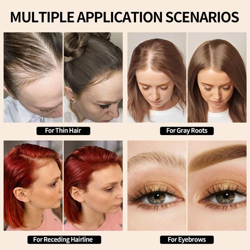5PCS Root Cover Up Powder for Women, Root Touch Up Hair Color for Gray Coverage, Hairline Powder Instantly Conceals Hair Loss Thinning Hair Bald Spot for Bald Spots, Eyebrows, Beard Line (Dark Brown)
