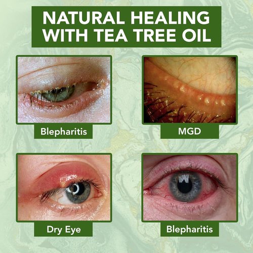NOVEHA Tea Tree Oil Eye Cream - Anti-Wrinkle Treatment for Dry Skin | 1.69 Fl. Oz. Moisturizer