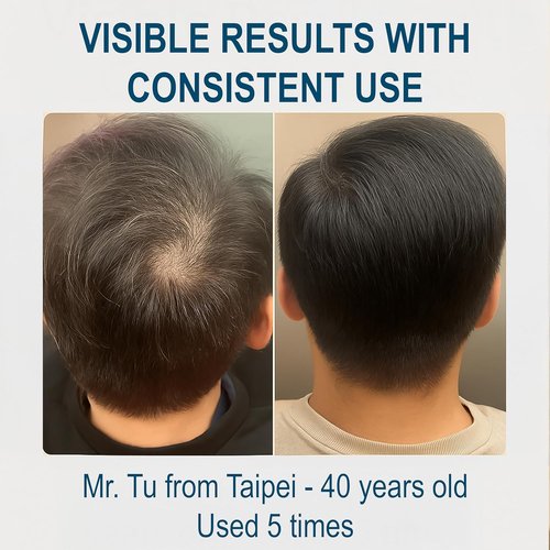 Biochemical Pulse Exosome Hair Growth Serum - Boost Hair Density & Reduce Shedding | 30ml Daily Treatment for Healthy Scalp