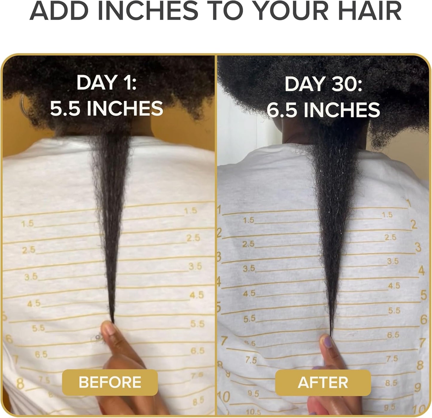 Shedavi Iconic Natural Hair Vitamins - Fast Hair Growth & Thicker, Stronger Hair | Vegan Supplements (60 Capsules)