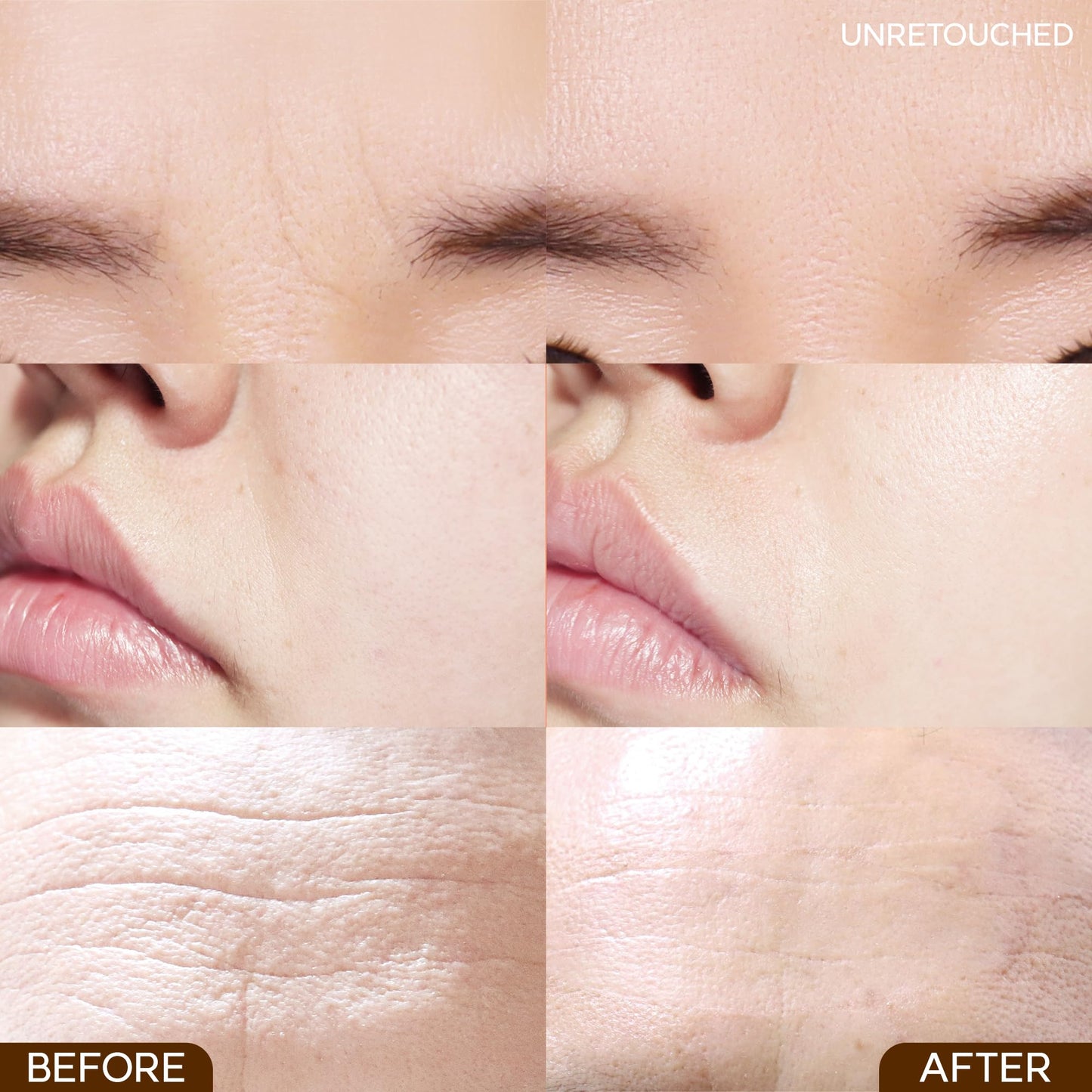 Marshique Between the Eyes Wrinkle Patches - Gifts for Mom & Dad - Frown Lines Eleven Lines Non invasive Face Wrinkles Smoothers - Korea Beauty Care, 55 Patches