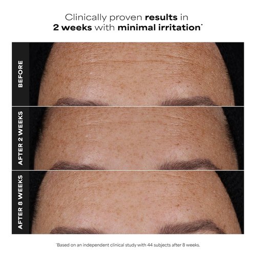 Paula’s Choice Pro Retinaldehyde Serum - High Potency Anti-Aging Treatment for Radiant Skin | Fragrance-Free