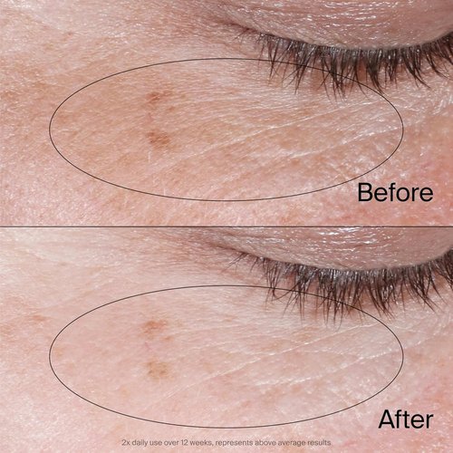 Neutrogena Collagen Bank Eye Cream - Revitalizes Under Eyes, Reduces Dark Circles & Puffiness | 0.5 oz
