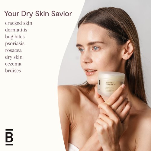 Blossom Honeybutter Cream for Toddlers and Adults - Eczema Relief for Sensitive Skin - Organic Manuka Honey