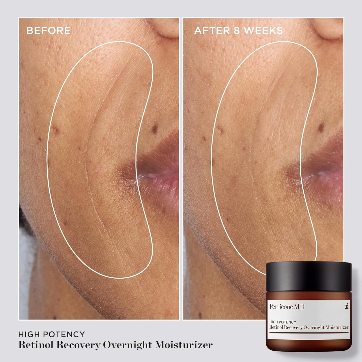 High Potency Classics Retinol Recovery Moisturizer - Overnight Anti-Aging Formula
