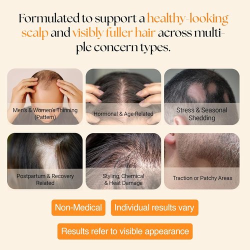ReGlow Micro-Infusion Hair Density System - Precision Applicators & Bio-Active Serum for Fuller Hair | 6 Applications