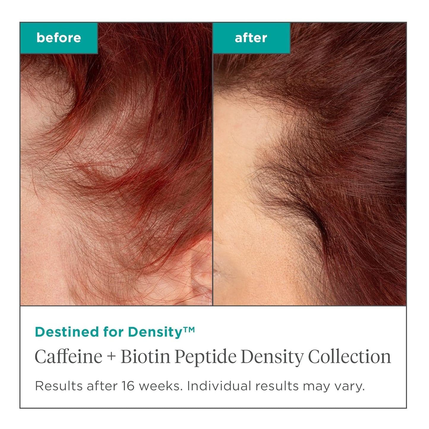 Briogeo Destined For Density Caffeine + Biotin Peptide Density Shampoo, Increases Hair Thickness, Volume and Density for Fine or Thinning Hair, Vegan, Cruelty-Free