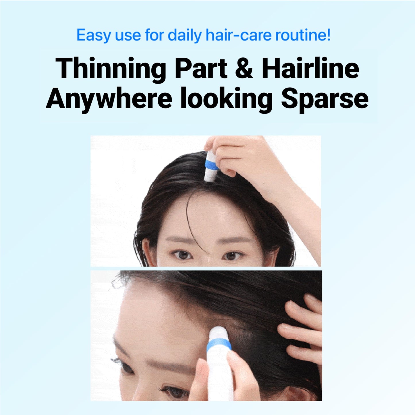 Seapuri Scalphy Viral Hair Growth Treatment Topical Serum for Hair Loss, Thinning, Receding Hairline | Cooling Rollerball Scalp Massager for Men and Women | Hair Regrowth | Korean Beauty 0.67 Fl Oz