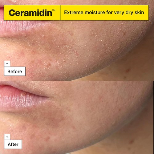 Dr.Jart+ Ceramidin Ectoin-Infused Face Cream - Hydrating Moisturizer for Dry Skin | 1.69 Fl Oz