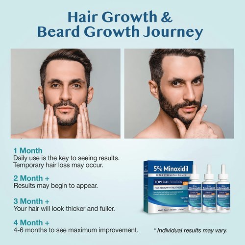 5% Minoxidil Hair Growth for Men and Women: Extra Strength Beard Regrowth Treatment Serum with Minoxidil and Biotin for Thinning Hair Loss to Grow Thicker Fuller 60ml 3 Bottles