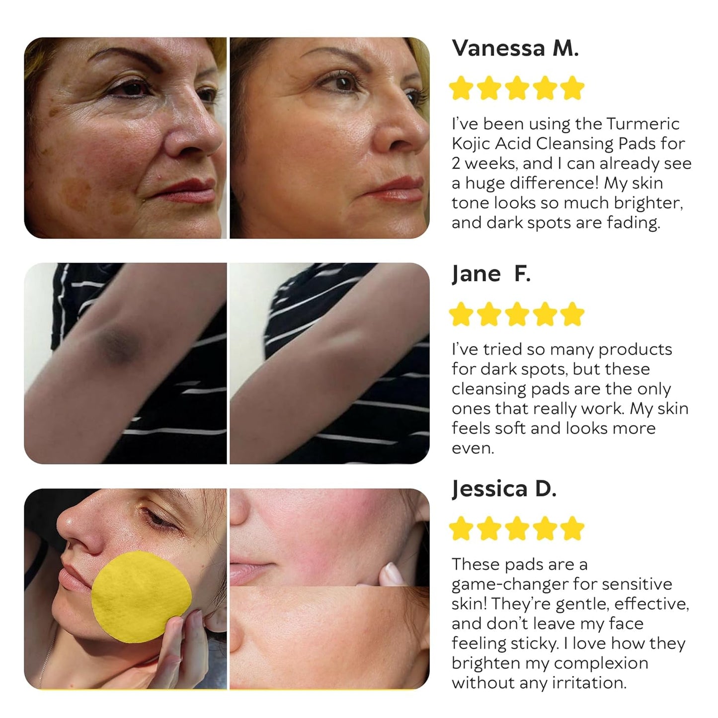 Turmeric Kojic Acid Cleansing Pads - Exfoliating Face Sponges with Vitamin C & Lemon for Glowing Skin