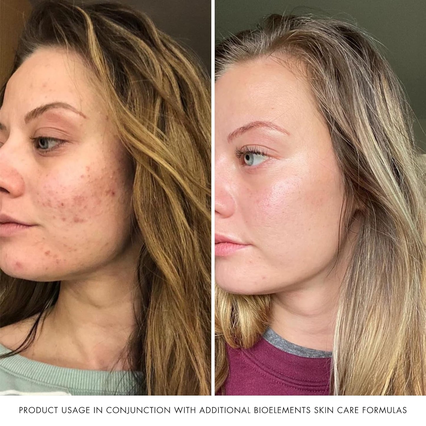 Bioelements RayDefense - Hydrating Broad-Spectrum SPF 30 Sunscreen & Moisturizer - 4 fl oz - Vegan & Gluten-Free