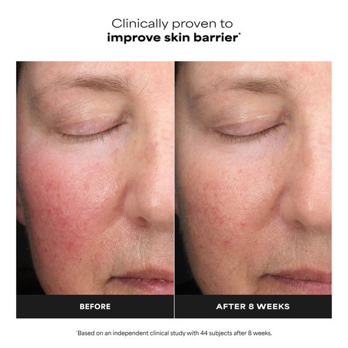 Paula’s Choice Liquid Face Exfoliant 6% Mandelic Acid + 2% Lactic Acid Exfoliant, Gentle Daily AHA Exfoliation for Discoloration, Bumpy Texture & Radiance, for Sensitive Skin, Fragrance-Free, 1 fl oz