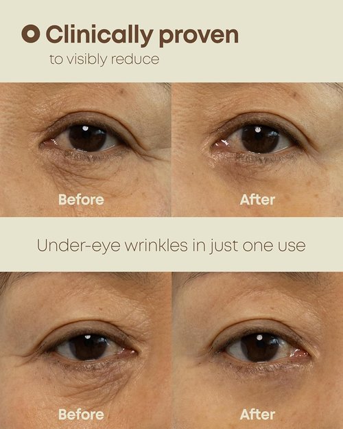 NINELESS Ever-Youth Eye Cream - Instant Lifting Technology with Niacinamide & Hyaluronic Acid | 0.5 fl oz