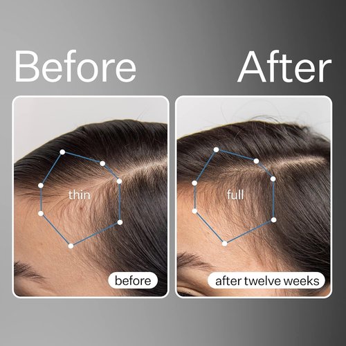 Act+ Acre Cold Processed Stem Cell Scalp Serum - Promotes Thicker Hair & Soothes Scalp - 1 fl oz