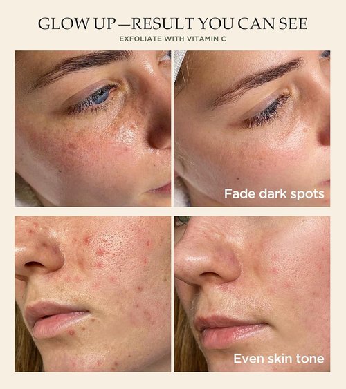 Revitalizing Exfoliation Face Scrub by [Brand Name] - Vitamin C & Turmeric for Blackheads & Dark Spots | 4.23 Fl Oz
