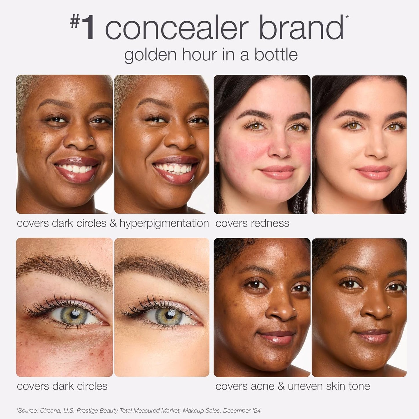 Tarte Shape Tape Radiant Concealer - Medium Coverage, Hydrating Formula for Dark Circles & Fine Lines, Vegan