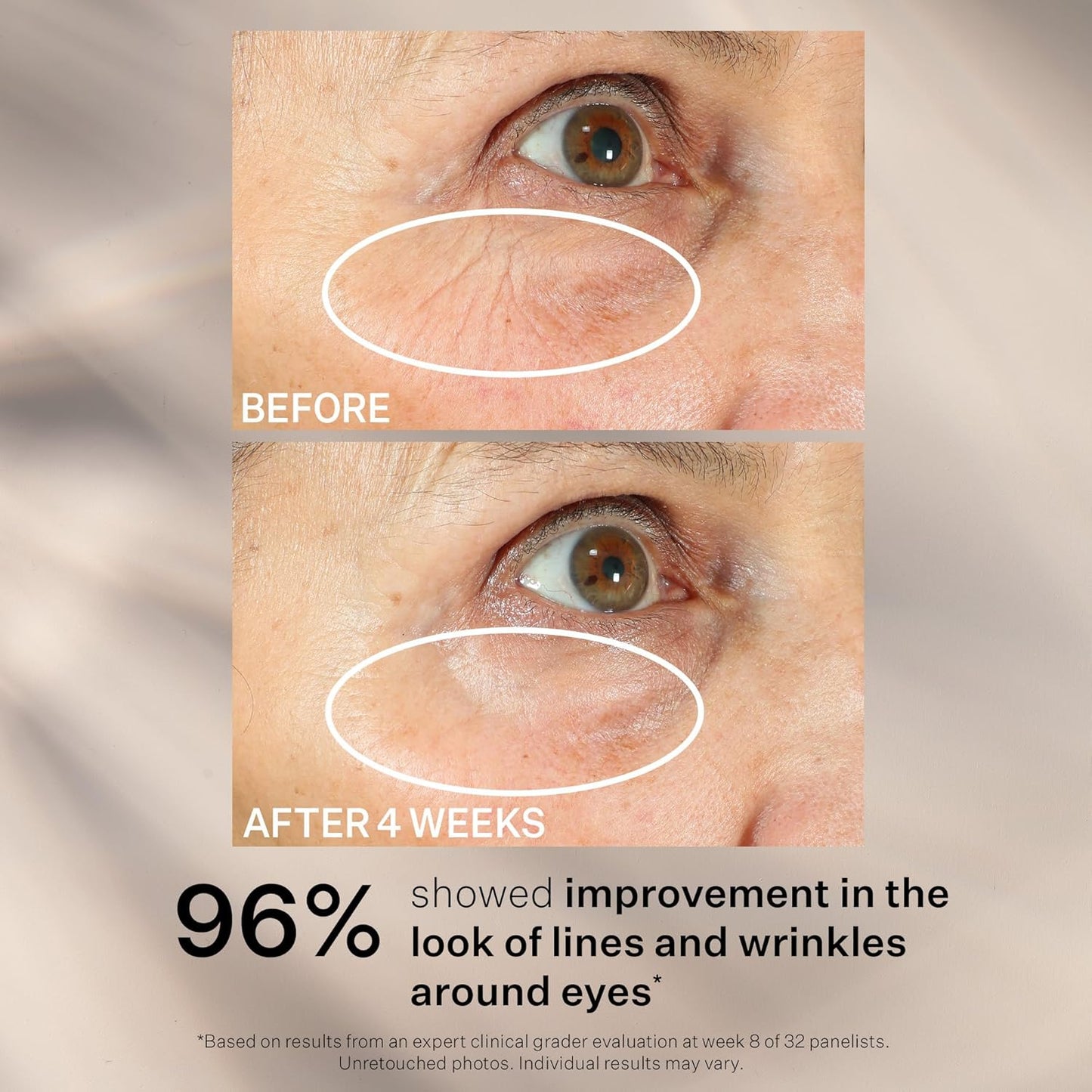 StriVectin Peptight Face Lift Serum - Tightening & Brightening Peptides for Youthful Skin