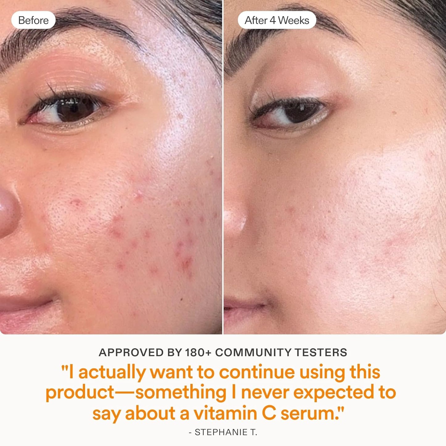 Skinfix Brighten + Firm Vitamin C Serum - 15% Concentration for Dark Spots & Fine Lines - Safe for Sensitive Skin