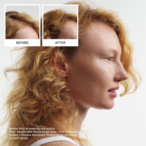 Nioxin Scalp + Hair Thickening Shampoo - Niacinamide & Biotin for Natural Hair | 33.8 Fl Oz
