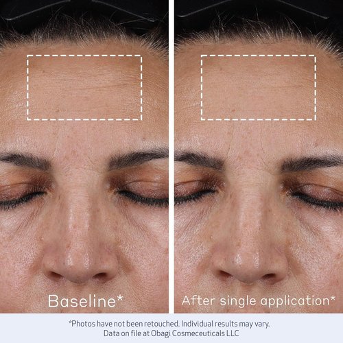 Obagi ELASTIderm Advanced Filler Concentrate - Non-Injectable Filler with Biomimetic Peptide Technology for Firm Skin & Reduced Fine Lines