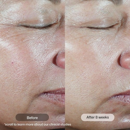 Revision Skincare C+ Correcting Complex 30%® Vitamin C Serum - Anti-Aging Brightening Treatment for Sensitive Skin