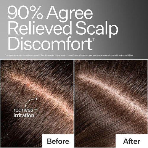 ACT+ ACRE Microbiome Cooling Scalp Serum - Instant Relief for Dry, Itchy Scalps - 2.2 fl oz