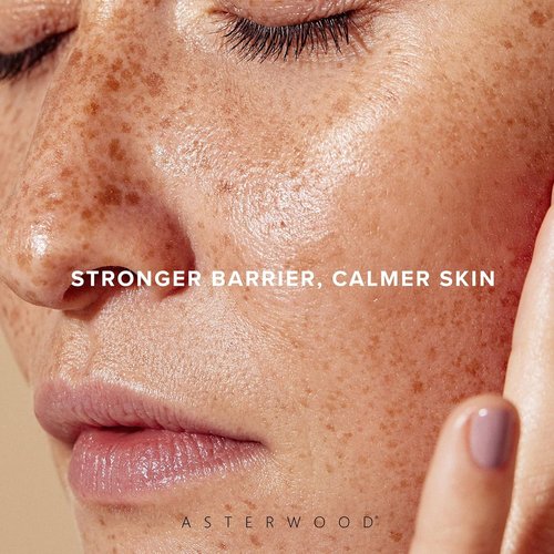 Asterwood Ceramide Barrier Repair Serum - Hydrating & Calming Facial Serum with Triple Ceramide Complex - 1 Fl Oz